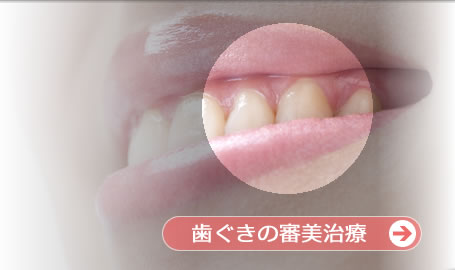 歯ぐきの形成・再生・移植